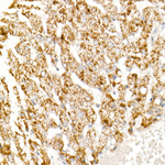HAO1 Antibody in Immunohistochemistry (Paraffin) (IHC (P))