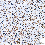 H3K9me1 Antibody in Immunohistochemistry (Paraffin) (IHC (P))