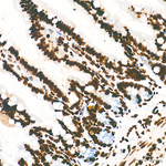 H3K9me1 Antibody in Immunohistochemistry (Paraffin) (IHC (P))
