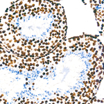 H3K9me1 Antibody in Immunohistochemistry (Paraffin) (IHC (P))