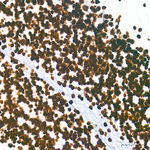 H3K9me1 Antibody in Immunohistochemistry (Paraffin) (IHC (P))