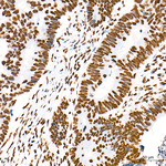 H3K79me2 Antibody in Immunohistochemistry (Paraffin) (IHC (P))