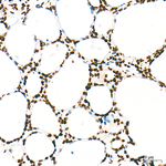 H3K79me2 Antibody in Immunohistochemistry (Paraffin) (IHC (P))