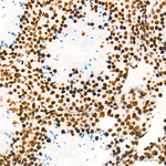 H3K79me2 Antibody in Immunohistochemistry (Paraffin) (IHC (P))