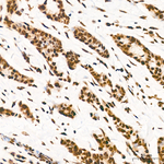 H3K36me2 Antibody in Immunohistochemistry (Paraffin) (IHC (P))