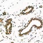 H3K36me2 Antibody in Immunohistochemistry (Paraffin) (IHC (P))