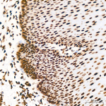 H3K36me2 Antibody in Immunohistochemistry (Paraffin) (IHC (P))