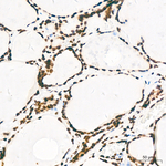 H3K36me2 Antibody in Immunohistochemistry (Paraffin) (IHC (P))