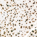 H3K36me2 Antibody in Immunohistochemistry (Paraffin) (IHC (P))