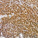 H3K36me2 Antibody in Immunohistochemistry (Paraffin) (IHC (P))