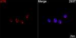 ATR Antibody in Immunocytochemistry (ICC/IF)