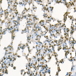 H3R8me2a Antibody in Immunohistochemistry (Paraffin) (IHC (P))