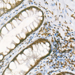 H3R8me2a Antibody in Immunohistochemistry (Paraffin) (IHC (P))