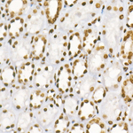 H3R8me2a Recombinant Rabbit Monoclonal Antibody (3S8H5)