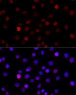 H3K27me1 Antibody in Immunocytochemistry (ICC/IF)
