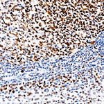 MSH2 Antibody in Immunohistochemistry (Paraffin) (IHC (P))