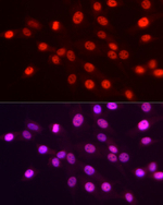 H3K4me3 Recombinant Rabbit Monoclonal Antibody (6F7R2)