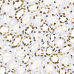 H3K4me3 Antibody in Immunohistochemistry (Paraffin) (IHC (P))