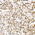 H3K4me3 Antibody in Immunohistochemistry (Paraffin) (IHC (P))