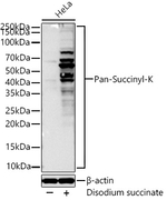 Pan Succinyl Lysine Recombinant Rabbit Monoclonal Antibody (4A3S5)