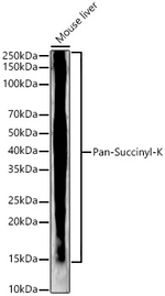 Pan Succinyl Lysine Antibody in Western Blot (WB)