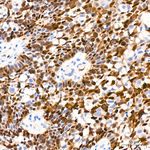 CDK1 Antibody in Immunohistochemistry (Paraffin) (IHC (P))