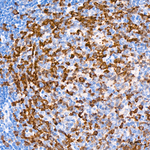 CDK1 Antibody in Immunohistochemistry (Paraffin) (IHC (P))
