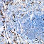 CDK1 Antibody in Immunohistochemistry (Paraffin) (IHC (P))