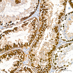 CDK1 Antibody in Immunohistochemistry (Paraffin) (IHC (P))