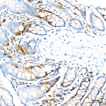 CDK1 Antibody in Immunohistochemistry (Paraffin) (IHC (P))