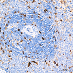 CDK1 Antibody in Immunohistochemistry (Paraffin) (IHC (P))