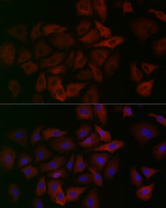 ALDH1A1 Recombinant Rabbit Monoclonal Antibody (6P6G4)