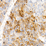 ALDH1A1 Antibody in Immunohistochemistry (Paraffin) (IHC (P))