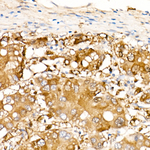 ALDH1A1 Antibody in Immunohistochemistry (Paraffin) (IHC (P))