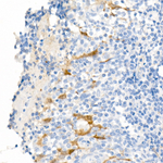 ALDH1A1 Antibody in Immunohistochemistry (Paraffin) (IHC (P))