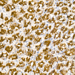 ALDH1A1 Antibody in Immunohistochemistry (Paraffin) (IHC (P))