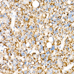 ACOX1 Antibody in Immunohistochemistry (Paraffin) (IHC (P))