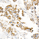 ACOX1 Antibody in Immunohistochemistry (Paraffin) (IHC (P))