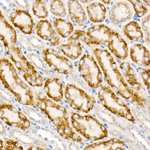 ACOX1 Antibody in Immunohistochemistry (Paraffin) (IHC (P))