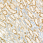 ACOX1 Antibody in Immunohistochemistry (Paraffin) (IHC (P))