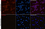 CD79a Recombinant Rabbit Monoclonal Antibody (4C6D3)
