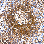CD79a Antibody in Immunohistochemistry (Paraffin) (IHC (P))