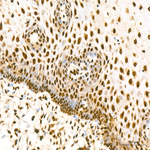H3K56ac Antibody in Immunohistochemistry (Paraffin) (IHC (P))
