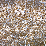 H3K56ac Antibody in Immunohistochemistry (Paraffin) (IHC (P))
