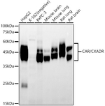 CAR Antibody in Western Blot (WB)