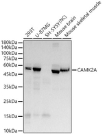 CaMKII alpha Antibody in Western Blot (WB)