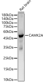 CaMKII alpha Antibody in Western Blot (WB)