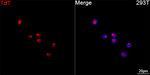 TdT Antibody in Immunocytochemistry (ICC/IF)