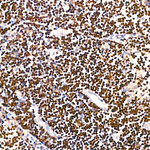 TdT Antibody in Immunohistochemistry (Paraffin) (IHC (P))