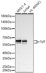 TdT Antibody in Western Blot (WB)